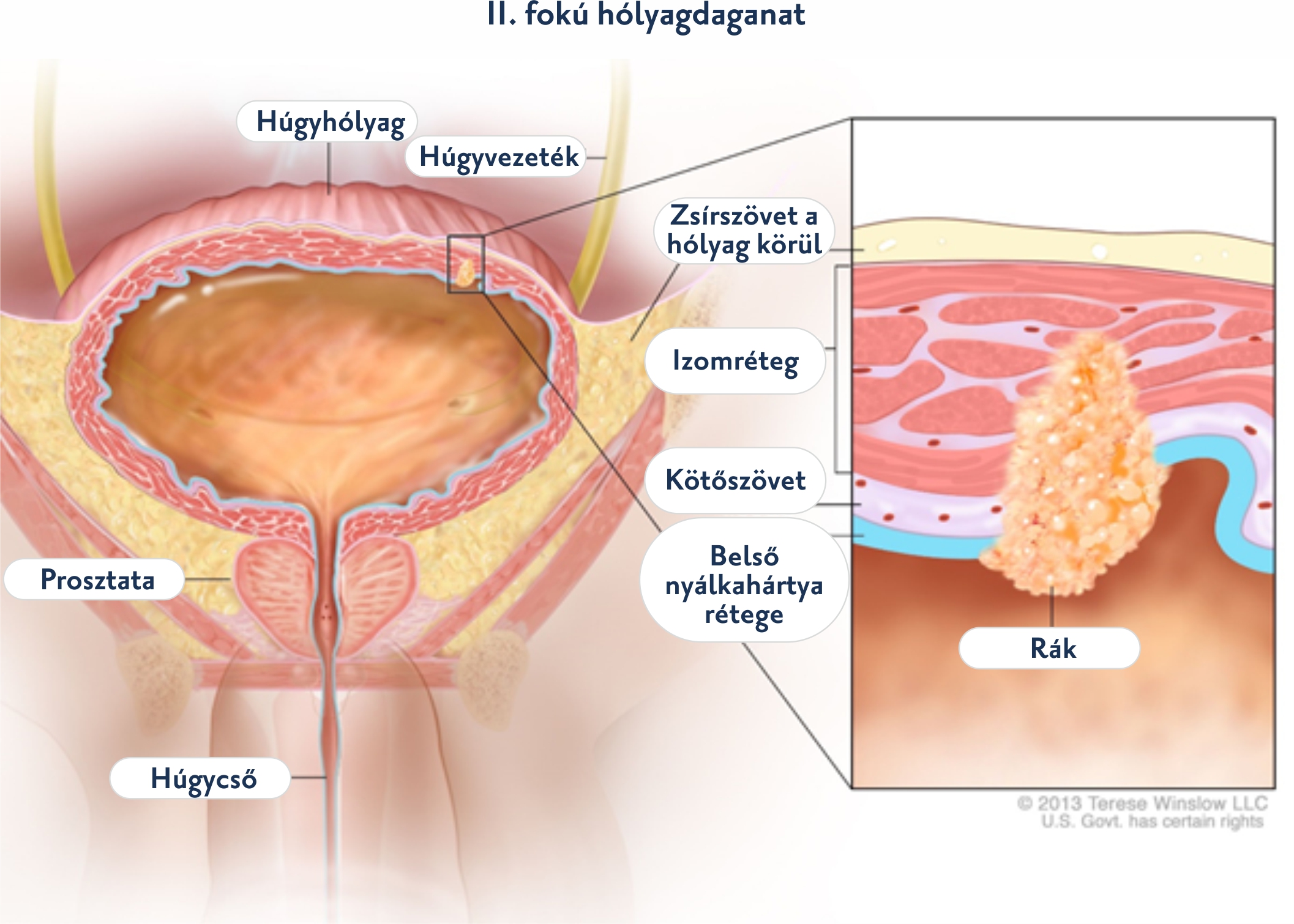 Húgycső- és hólyagtükrözés (urethrocystoscopia)