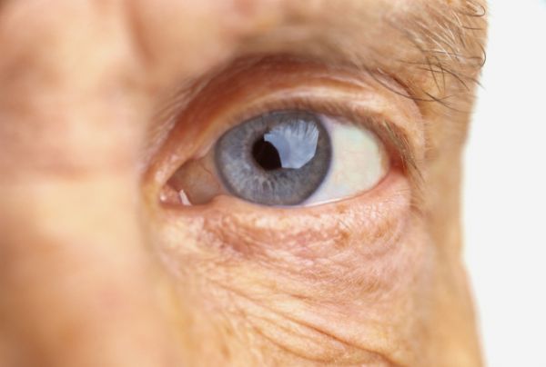 Makula ödéma stressz - az időskori makuladegeneráció a retina központi részének a makulának