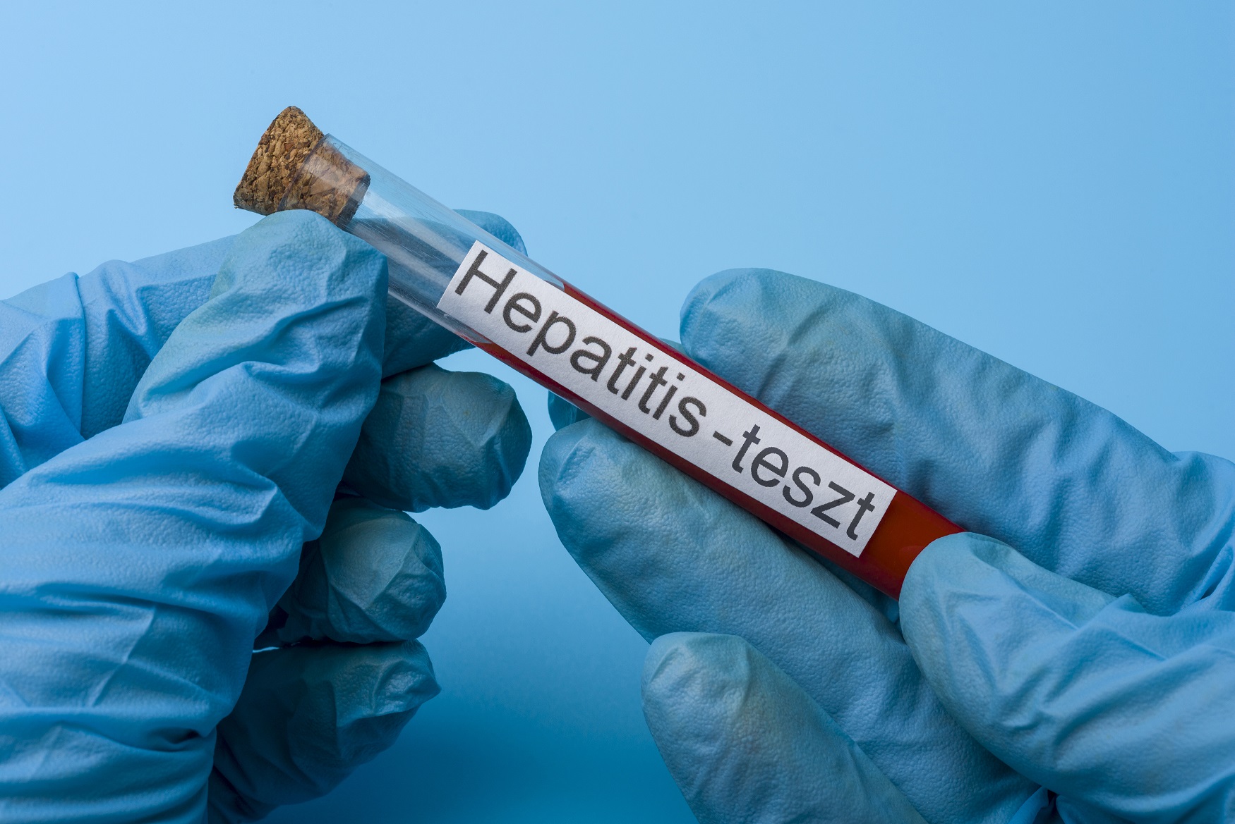 Július 28. a hepatitis világnapja