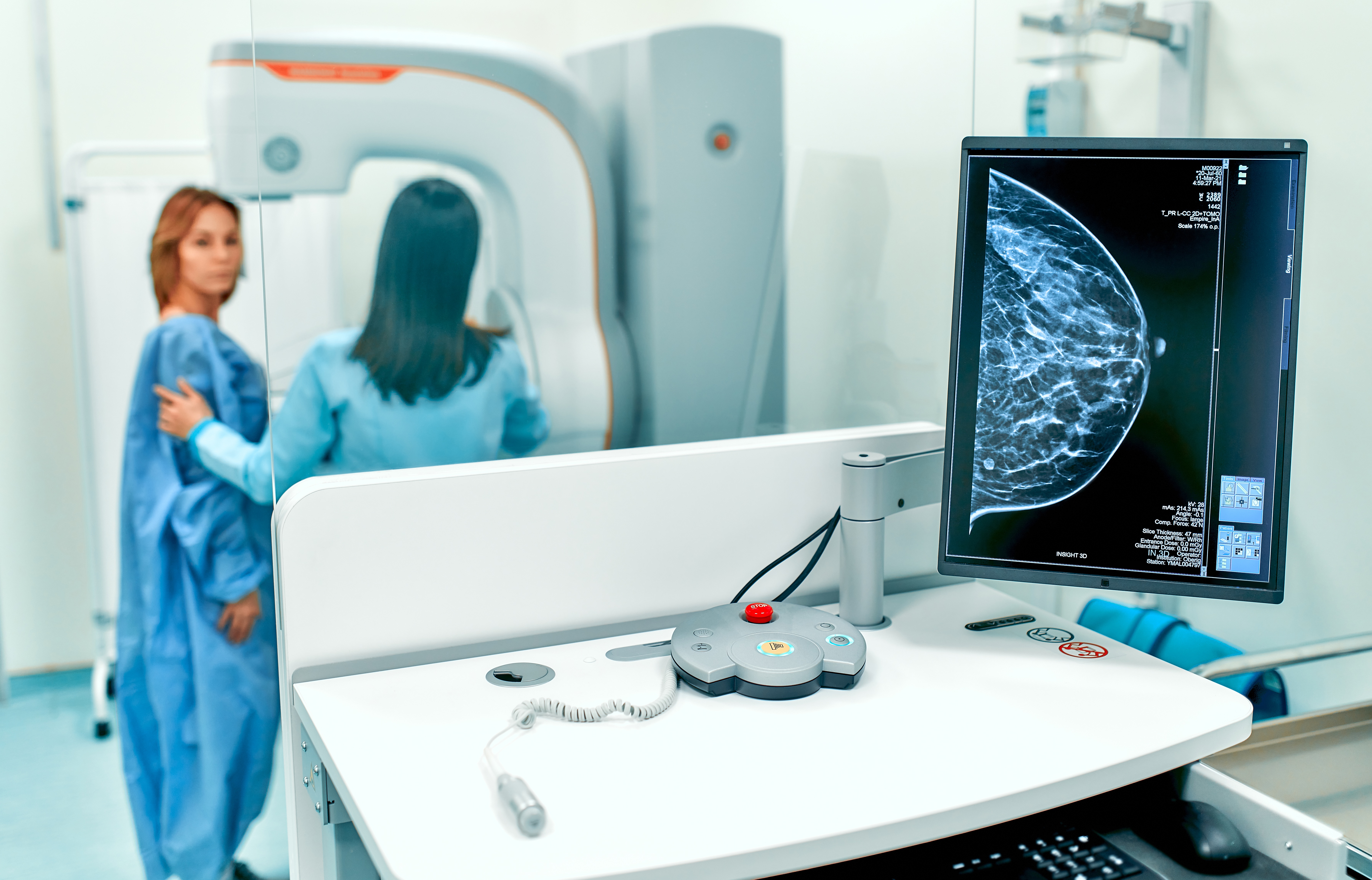 Emlőultrahang és mammográfia – Ön tudja, mikor melyik javasolt?