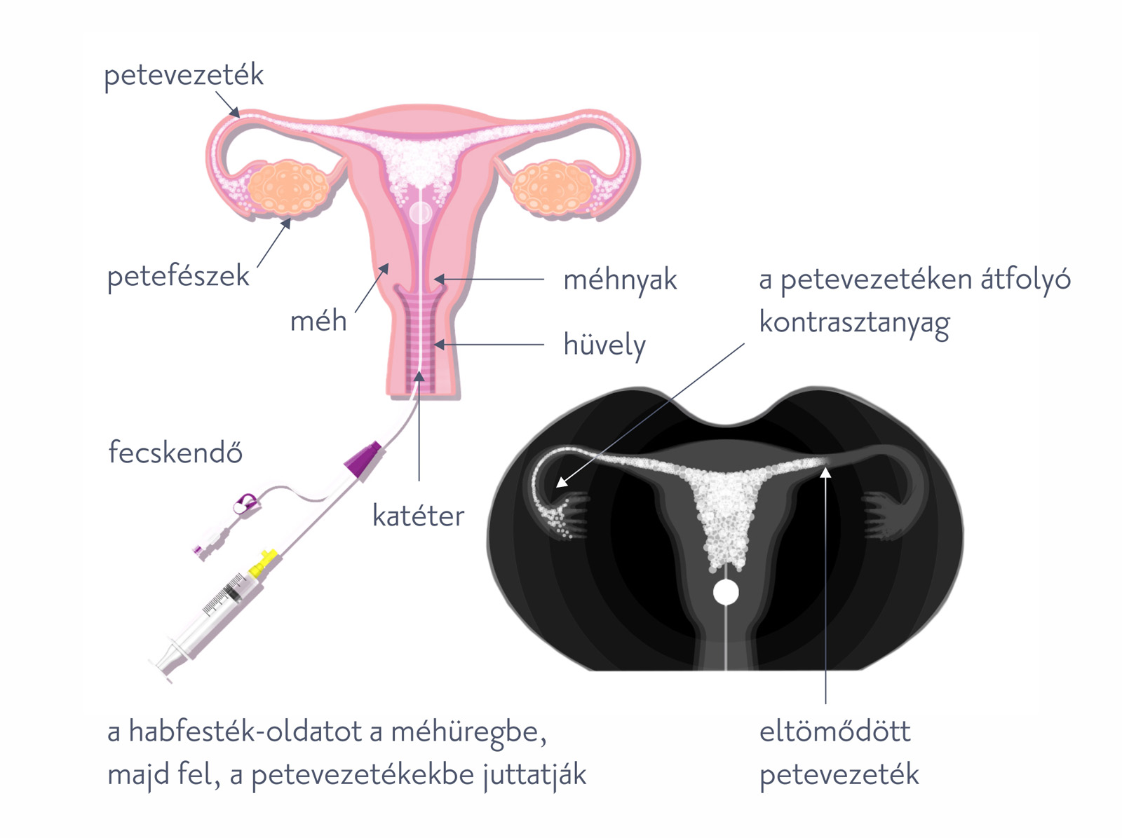 Nőgyógyászati műtét - Budai Egészségközpont