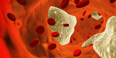 A hematológia a vérképző- és a nyirokszervek betegségeivel foglalkozik.