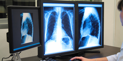 A pulmonológia a légutak megbetegedéseivel foglalkozó szakterülete az orvostudománynak.